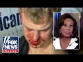 BEATEN TO A PULP Judge Jeanine denounces coddling of teen criminals