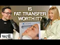 2025 Cosmetic Trends The Truth About Facelifts Threads Fat Transfer Dr Miguel Mascaro