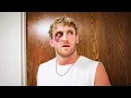 I Got Punched In The Face Not Clickbait