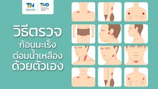 การตรวจคลำต่อมน้ำเหลืองด้วยตัวเองมีจุดประสงค์เพื่ออะไร