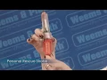 Weems and Plath Personal Rescue Strobe - How to use and operate