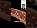 Lagu Pernah dengar obat jantung yang bekerja secepat kilat? Kenalan dengan Cangrelor! ⚡