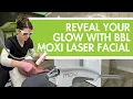 How BBL Moxi Laser Facials Transform Skin from the Inside Out 4Ever Young Merritt Island