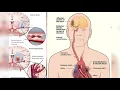 Download Lagu RUQYAH YANG DAPAT MERAWAT MENYAKIT STROKE ,LUMPUH, ANGIN AHMAR