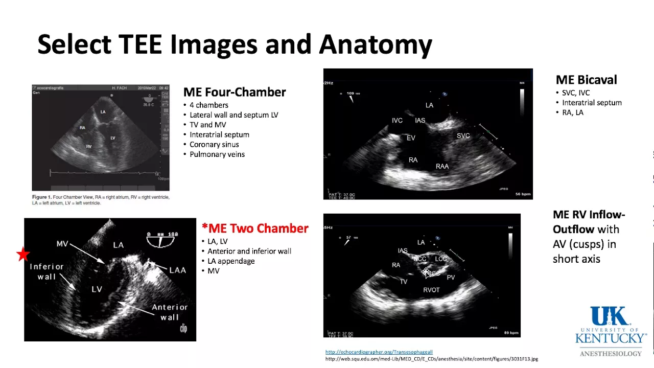 University of Kentucky Cardiac Keyword Review Part 1 of 3 - (Dr. Schell)
