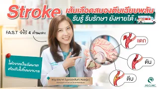 ยาละลายลิ่มเลือดที่ใช้รักษาสตroke คืออะไร