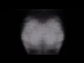 LORN - DRAWN OUT LIKE AN ACHE