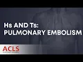 Hs and Ts - Pulmonary Embolism ACLS Certification Association