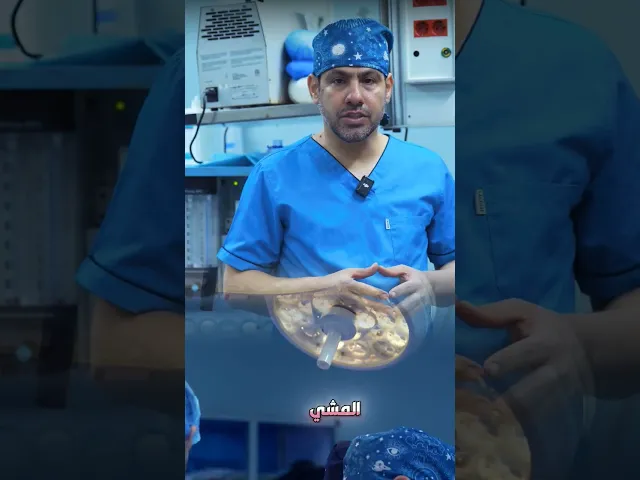 ⁣تغطينا لعملية تبديل المفصل الكامل