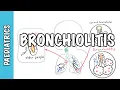 Bronchiolitis causes pathophysiology signs and symptoms treatment