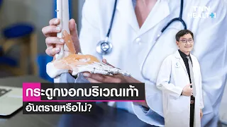 อาการของกระดูกงอกที่เท้าเป็นอย่างไร และควรรักษาอย่างไร