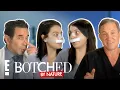 No Twin Cleft Behind FULL TRANSFORMATION Botched By Nature E