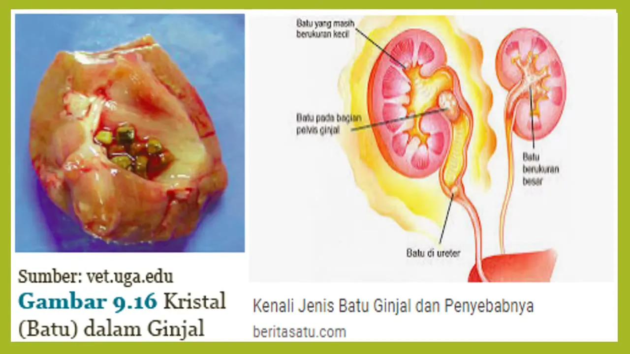 
          
          
          
            
            Bagaimanakah Gangguan pada Sistem Ekskresi Manusia?
          
        . 