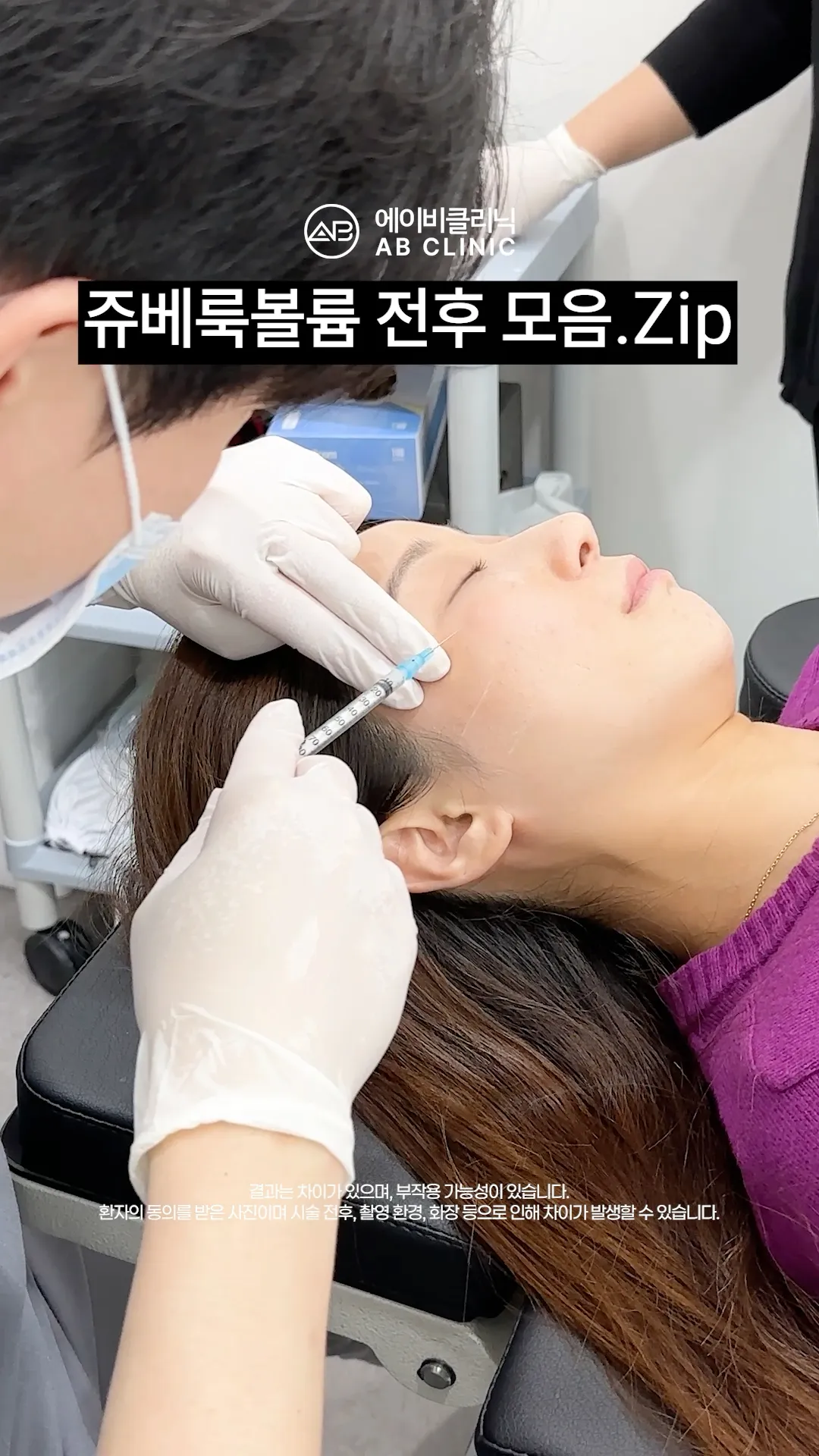 쥬베룩 볼륨 전후 모음ZIP.