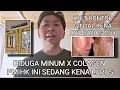 Download Lagu BARU BEBERAPA BULAN KERJA PMIHK INI KENA LUPUS AUTOIMUN! EGENSIINYA TANGGUNG JAWAB KO... BAHAS YUK