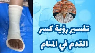 تفسير رؤية كسر القدم في المنام دندنها