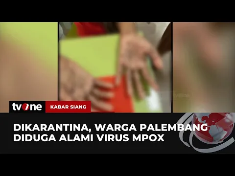 Waspada! Diduga Virus Mpox Menyerang Warga Palembang