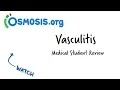 Vasculitis Clinical Presentation