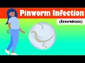 Pinworm Infection Enterobiasis - Causes Signs Symptoms Treatment