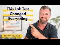 The Hidden Iron Test That Transforms AD Ferritin Explained