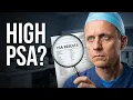 High PSA Doesn t Always Mean Cancer