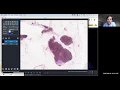 Multi-dimensional image visualization in Python using napari NEUBIAS Academy Home webinar