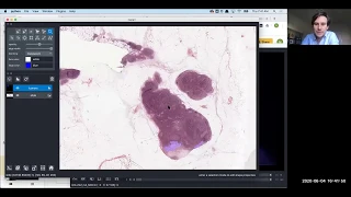 Multi-dimensional image visualization in Python using napari NEUBIAS Academy Home webinar