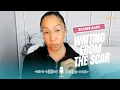 Download Lagu Writing From the Scar, Not the Wound