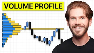 The ONLY Volume Profile Strategy You'll Ever Need