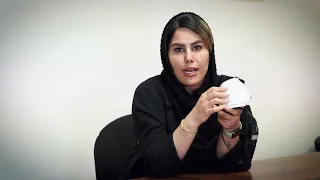 دوربین داهوا دندنها