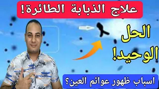 اسباب الذبابة السوداء في العين وطرق علاجها  علاج الذبابة الطائرة                       دندنها