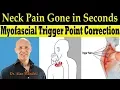Neck Pain Gone in Seconds Self-Help Myofascial Trigger Point Correction - Dr Alan Mandell DC