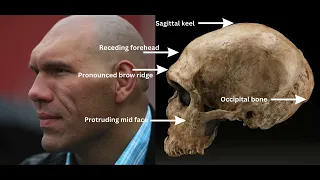 Download 6 Neanderthal DNA physical traits in modern humans MP3