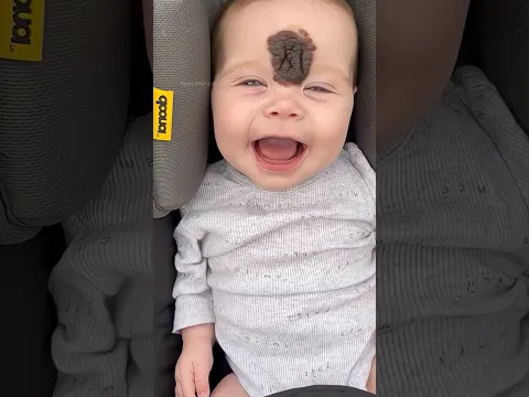 This Little Girl’s Transformation Is Incredible ❤️