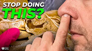 Why Picking Your Nose Can Be Dangerous