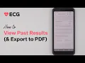 Fitbit Sense ECG - How to View Past Results and Export to PDF