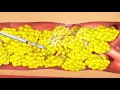 SEE HOW IT WORKS Water Assisted Liposuction with body jet