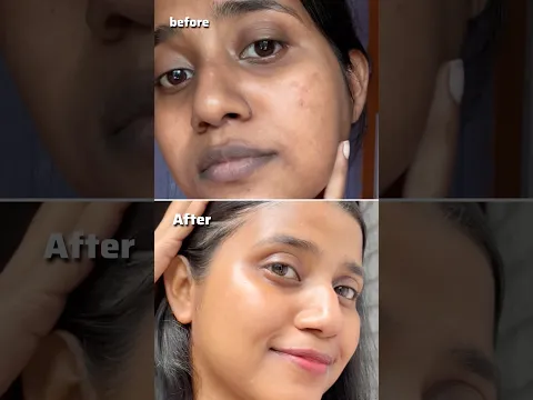 Best serum for dull skin 😱/#skincare #skincaretips #shorts
