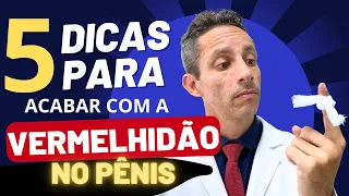 5 DICAS PARA ACABAR COM A VERMELHIDÃO DO PÊNIS | Prevenção da Balanopostite de Repetição