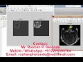 Image Fusion using Wavelet Transform Matlab Project Source Code