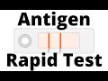 How SARS-CoV2 Antigen Rapid Tests work Covid-19 Testing