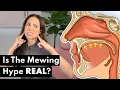 Download Lagu What Is Mewing \u0026 Does It ACTUALLY Work?