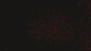 ASMR The Sound Of Hitting The Rear صوت ضرب 