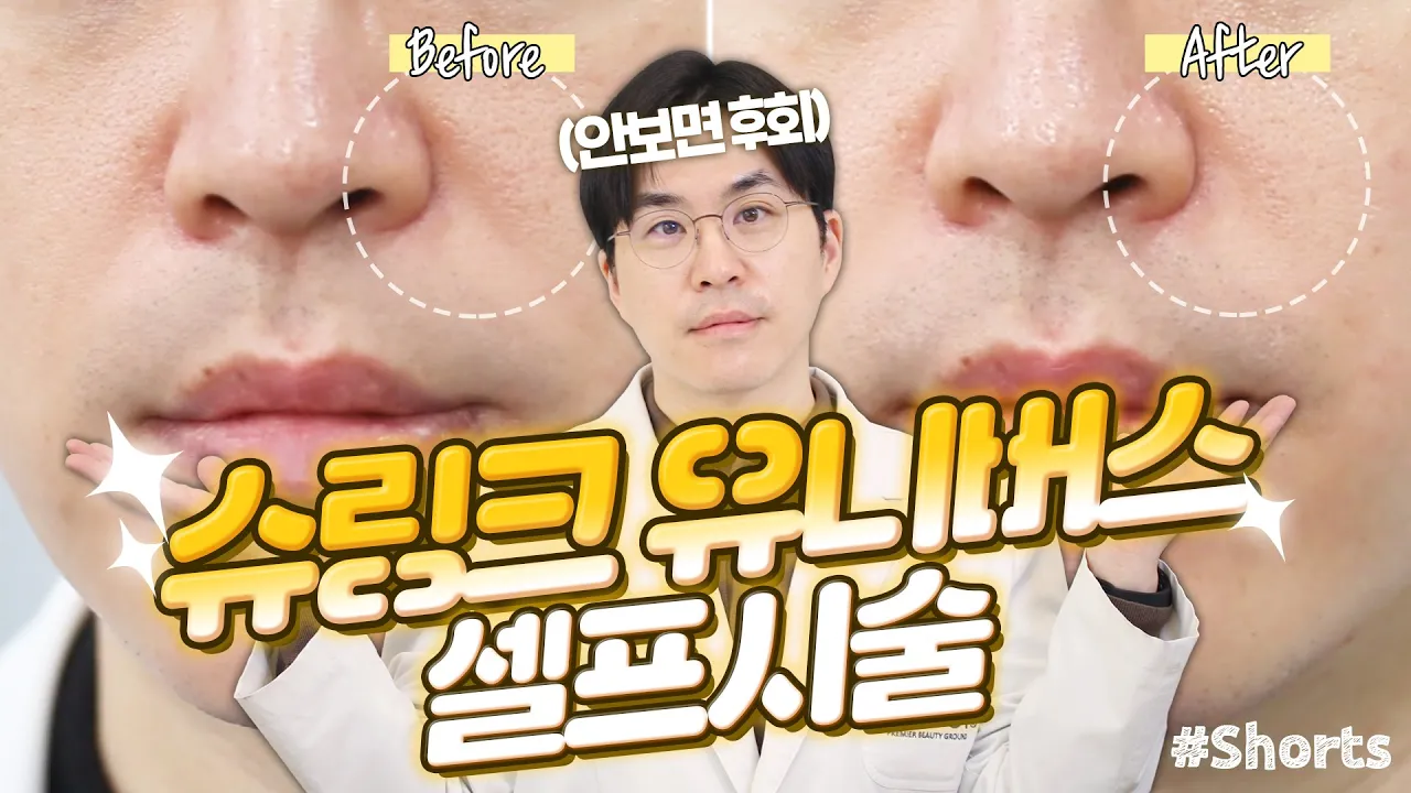 슈링크 유니버스 비포에프터 공개!! 리프팅 레이저의 새로운 시대가 열린다!!ㅣ슈링크 유니버스 부스터, 슈링크 유니버스 후기ㅣ제이필TV #Shorts