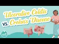 Ulcerative Colitis vs Crohn s Disease - Know the Difference Med Surg Help for Nursing School