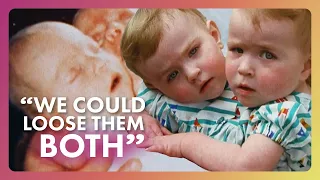 The Impossible Choice of Conjoined Twins Extraordinary People
