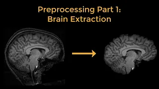 fMRI Short Course Preprocessing Part 1 - Brain Extraction