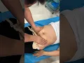 Pijat Perut Setelah Melahirkan Anak❓️ #shorts #shortvideo