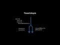 C Threads for Game Programming