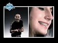 Diab - El Shahn Fasal (Music Video) | (دياب - الشحن فصل (فيديو كليب